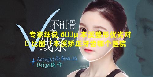 专家细说 🌵 本溪整形优劣对 ☘ 比图「本溪矫正牙齿哪个医院权威」